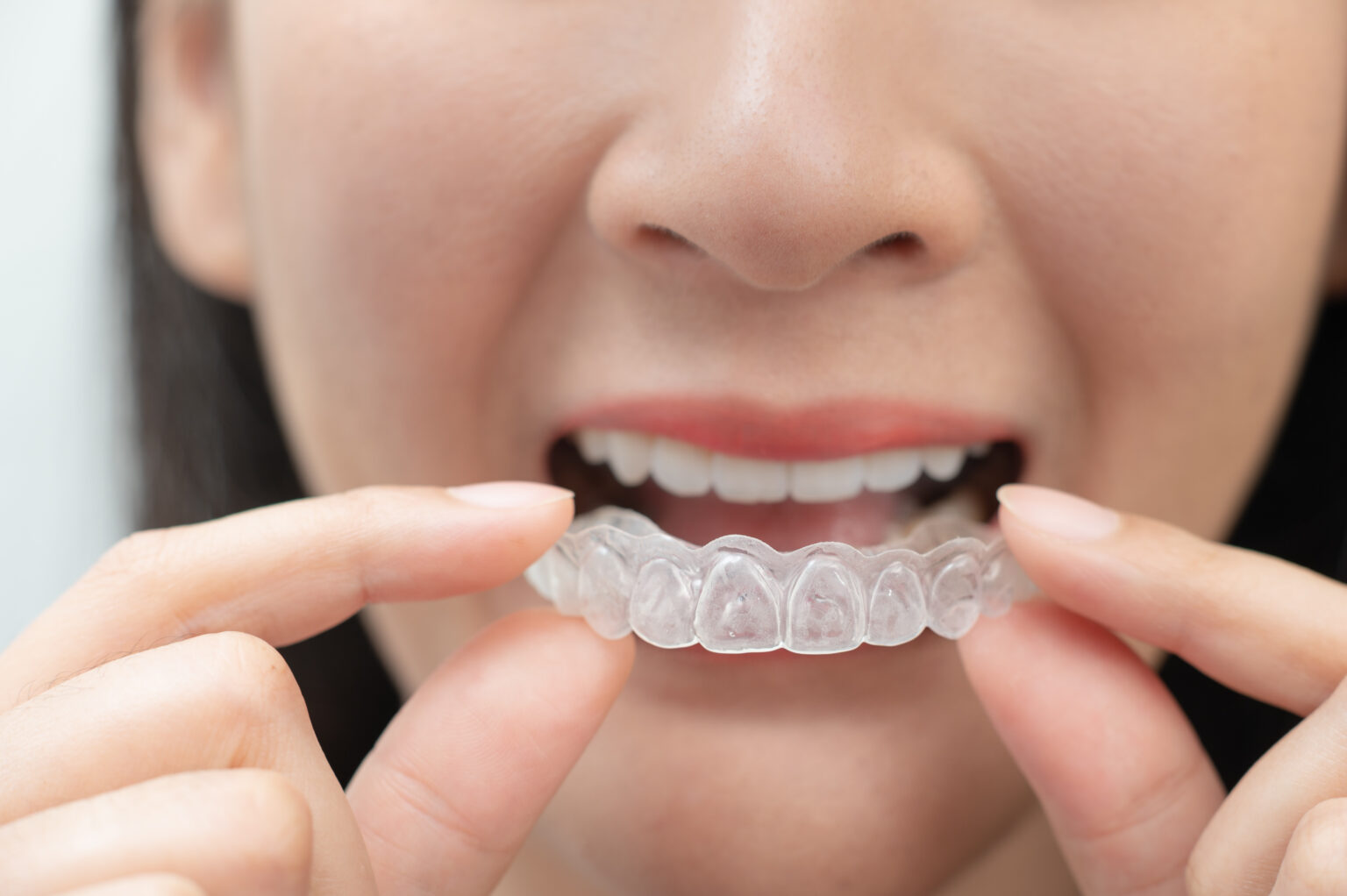 Invisalign New Braunfels
