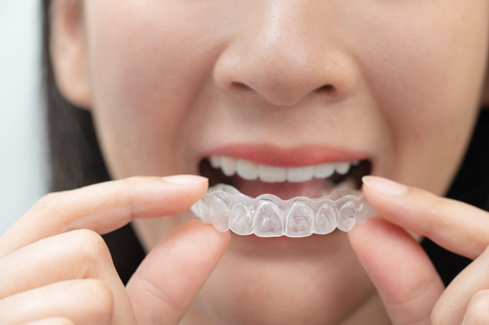 Invisalign New Braunfels
