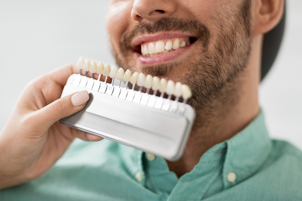 Porcelain Veneers in New Braunfels